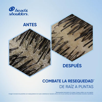 HEAD AND SHOULDERS SHAMPOO ANTI-RESEQUEDAD MIEL Y ACEITES Y ESENCIALES 12/180 ML
